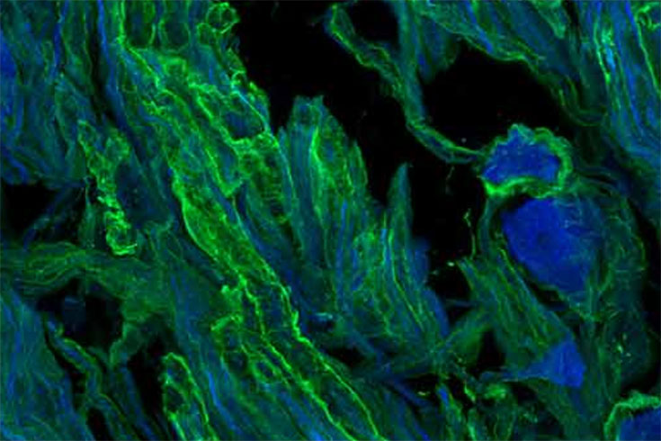 Brightly colored cells